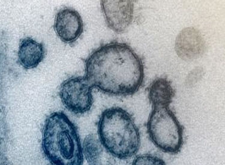 Οι πρώτες εικόνες του Κορωνοϊού από μικροσκόπιο