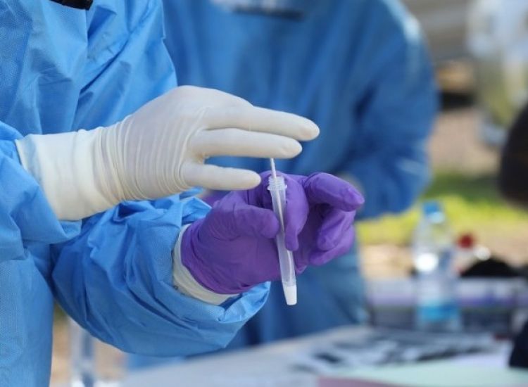 Επ. Αμμοχώστου: Αυτά τα εργαστήρια θα παραμένουν ανοιχτά για PCR και rapid τεστ (ΠΙΝΑΚΑΣ)