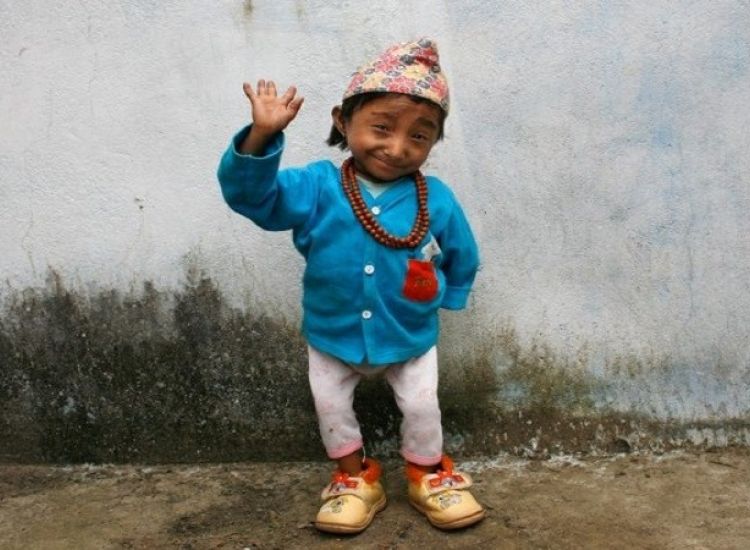 Πέθανε από πνευμονία στα 27 του χρόνια ο πιο μικρόσωμος άνθρωπος του κόσμου